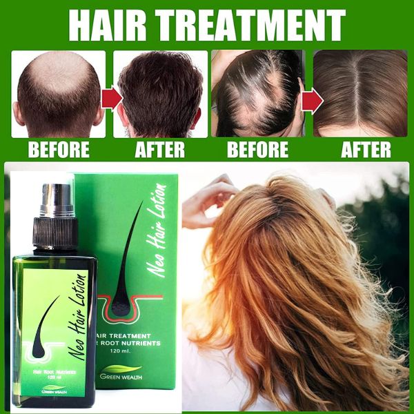 Green Wealth NEO Hair Oil for Hair Growth + Free Derma Roller for Hair  Growth – Moollis